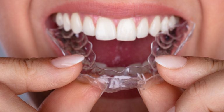 Bassett Creek Dental -Invisalign