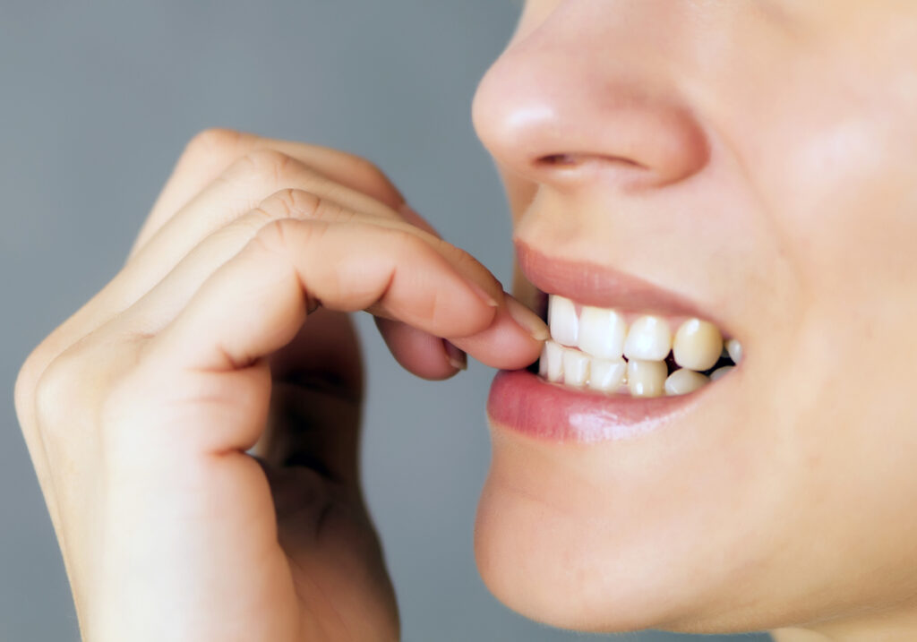 Nail Biting and the Effects on Your Smile