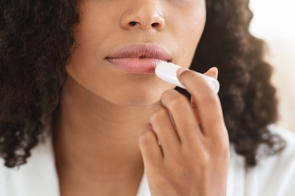 Chapped Lips Remedies. Black Woman Applying Chapstick Moisturizing Lip Balm, Cropped Image, Closeup