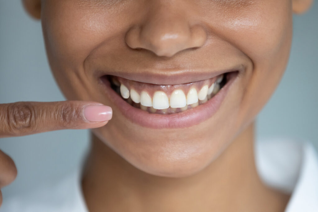 Close up woman point finger at perfect straight toothy smile.